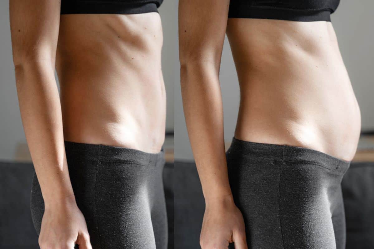 How long does diastasis recti take to improve Greater London (Croydon)?