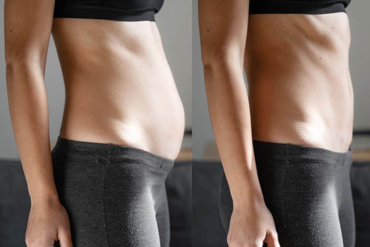 Post-Pregnancy: What Happens to Your Abdominal Muscles After Birth Greater London (Croydon)