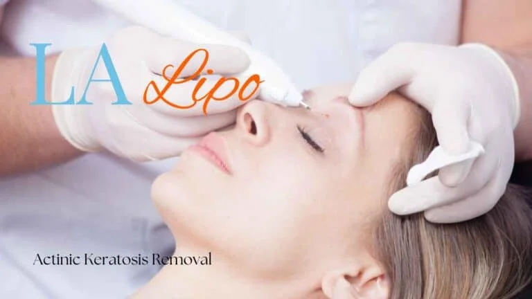 Woman receiving Actinic Keratosis Removal Treatment Greater London (Croydon)