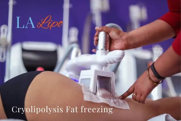 women getting fat freezing Greater London (Croydon)