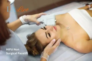 Woman having Hi-Fu to reduce wrinkles Greater London (Croydon).