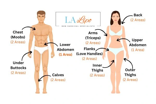 LA LIPO Cryolipolysis Areas Greater London (Croydon)