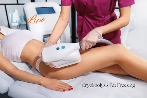 Woman receiving coolsculpting Greater London (Croydon) treatment on her thighs