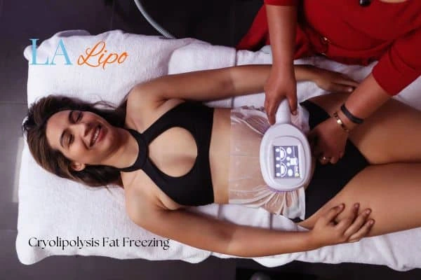 woman getting cryolipolysis Greater London (Croydon)