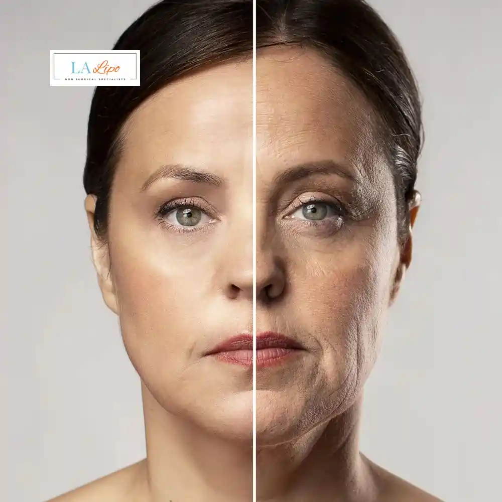 How Can You Tell If Non-Surgical Skin Tightening Is Right for You Greater London (Croydon)?