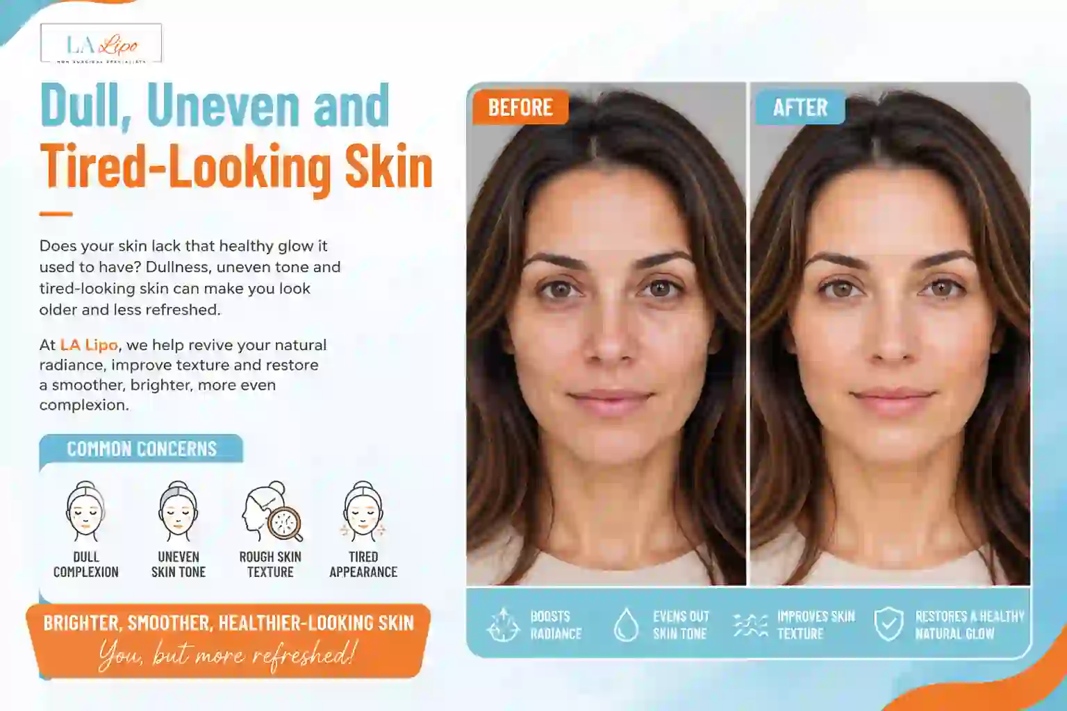Sign #5: Dull, Uneven and Tired-Looking Skin Greater London (Croydon)