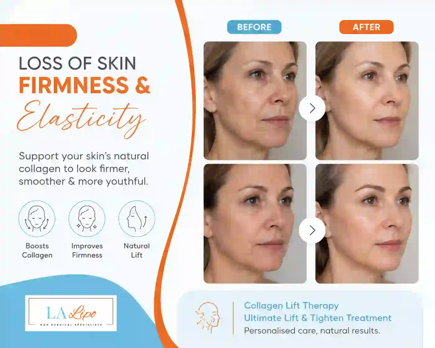 Sign #7: Loss of Skin Firmness and Elasticity Greater London (Croydon)