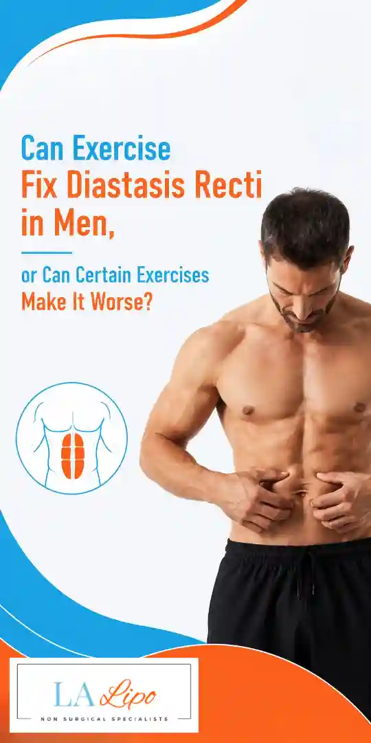 Can Exercise Fix Diastasis Recti in Men, or Can Certain Exercises Make It Worse Greater London (Croydon)?